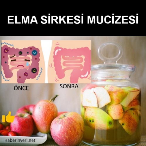 Elma sirkesi mucizesi