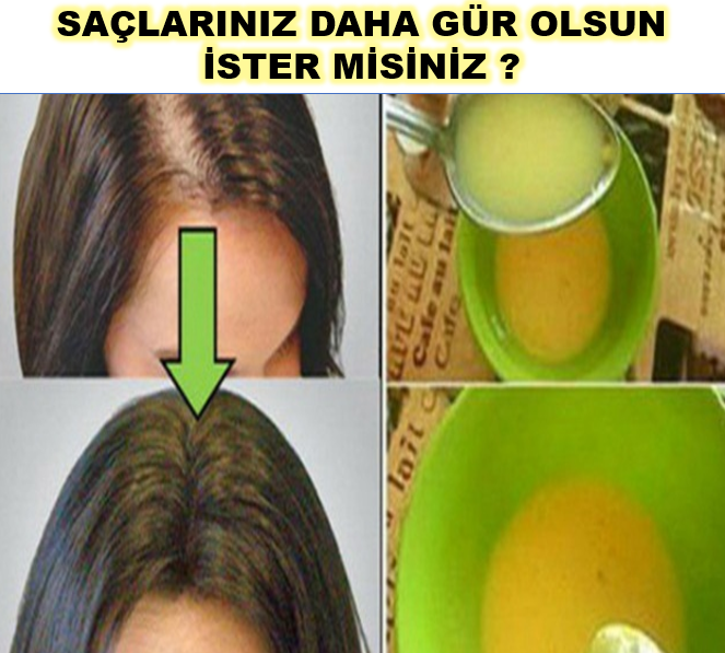 Hızlı Saç Uzatan Etkili Maske Tarifi