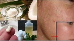 Yüzünüzü Yeniden Doğmuş Gibi Yapacak Doğal Maske..!