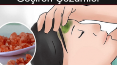 Baş Ağrısını 5 Dakikada Geçiren Mucize Çözüm