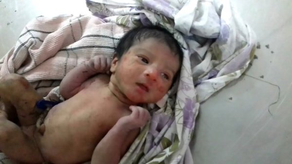 Çalılarda Bebek Buldu - Doktor Muayene Edince Gözlerine İnanamadı