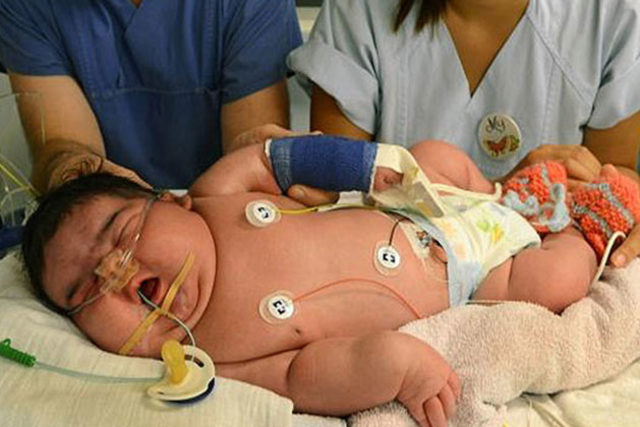 Dünyanın En Kilolu Bebeği Bakın Kaç Kilo Doğmuş!