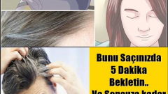 Saçınızda 5 dakika bekletin beyazlara veda edin