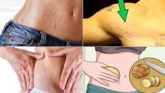 Bu 6 Doğal Tarifler Çatlaklardan Kurtulmak Mümkün