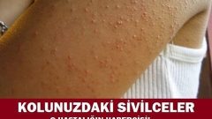 Meğer O Hastalığın Habercisiymiş…