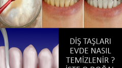 Diş Bakterileri Nasıl Temizlenir?İşte O Doğal Yöntem
