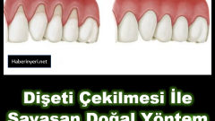 Diş Eti Çekilmesi İle Savaşan Doğal Yöntem