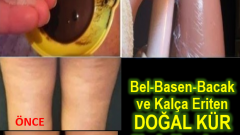Bel, Basen, Bacak ve Kalça Eriten Doğal Kür