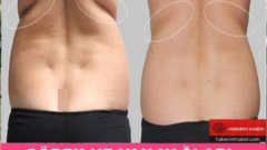 Göbek ve Yan Yağlari Yakmak İçin Altın Kurallar Bakın Neymiş