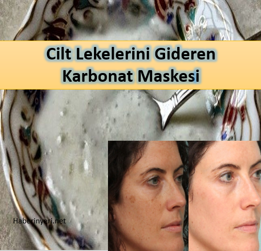 Lekesiz Bir Cilt İçin Yoğurt Karbonat Maskesi