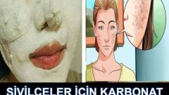Sivilceler için karbonat maskesi: Tamamen doğal ve etkili formül!