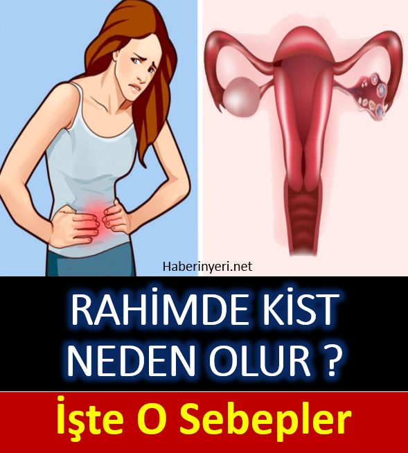 Rahim kistleri neden oluşur ?