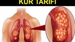 Akciğer kanserine düşman kür tarifi