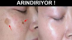 Sadece Üç Gecede Yüzünüzü Her Şeyden Arındıran Maske