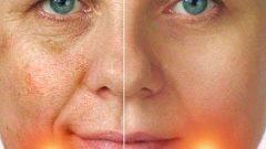 Yüz Maskesi İle Güzel Bir Cilde Sahip Olun !