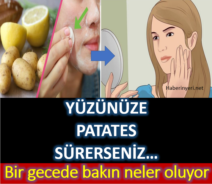 Yüzünüze Patates Sürerseniz 1 Gecede Bakın Neler Değişecek ?