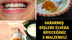 SARARMIŞ DİŞLERE ELVEDA DİYECEĞİNİZ 3 MALZEMELİ MUCİZE.