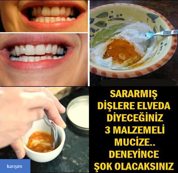 SARARMIŞ DİŞLERE ELVEDA DİYECEĞİNİZ 3 MALZEMELİ MUCİZE.