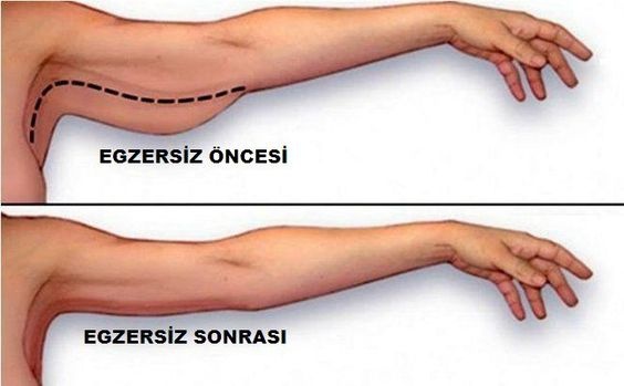 Sarkık Kollar için Egzersiz