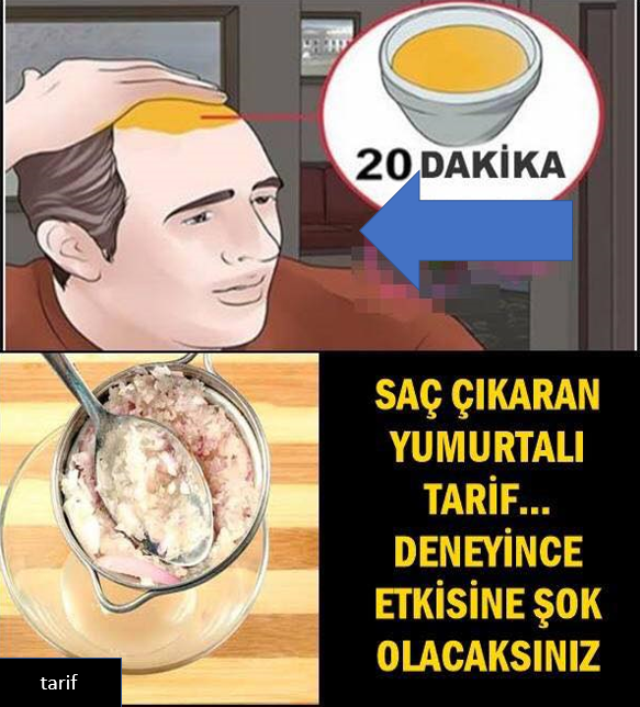 Saç uzmanlarını bile şaşırtacak tarifle şaçlarınız deli gibi uzayacak!