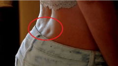 Sırtınızda Bu İki Gamzeniz Varsa Çok Özel Birisiniz