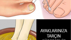 Ayaklarınıza Tarçın Sürerseniz Bakın Ne Oluyor