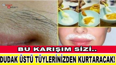 Bu Karışım Sizi Dudak Üstü Tüylerinizden Kurtaracak!