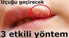 Uçuğu Anında Geçirebilecek Etkili Yöntem