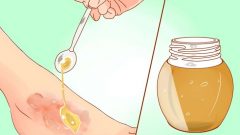 Yarayı En Güzel Şekilde İyileştiren 4 İpucu