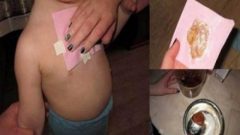 Tek Gecede Akciğerlerinizde Biriken Balgamı Zencefil Sargısı ile Atın