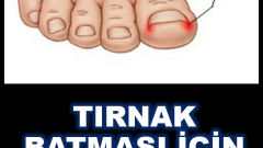 Tırnak batması için doğal yöntem