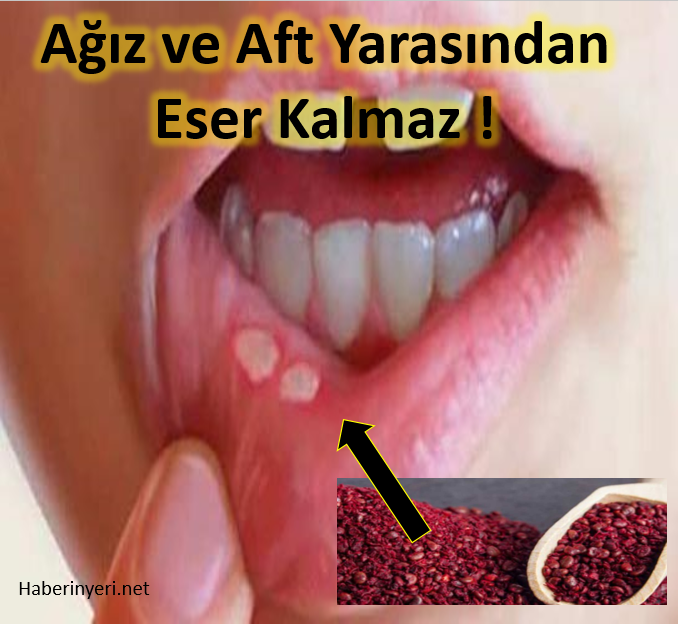 Aft Yaralarına Birebir Sumak