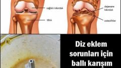 Diz Eklem Ağrıları İçin Ballı Karışım