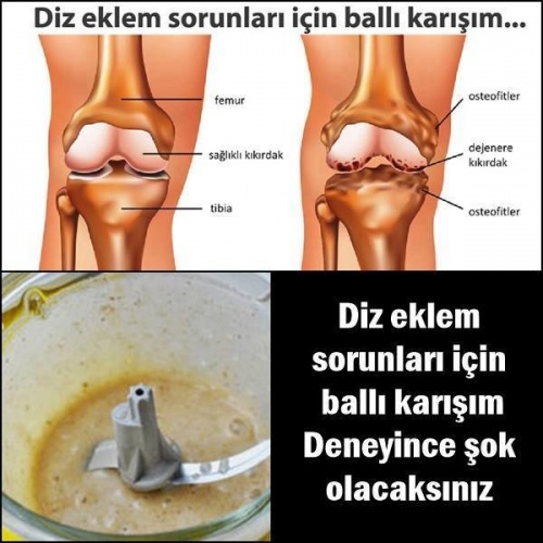 Diz Eklem Ağrıları İçin Ballı Karışım