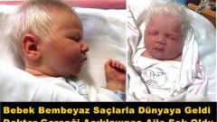 Bebek Bembeyaz Saçlarla Dünyaya Geldi Doktor Gerçeği Açıklayınca Aile Şok Oldu