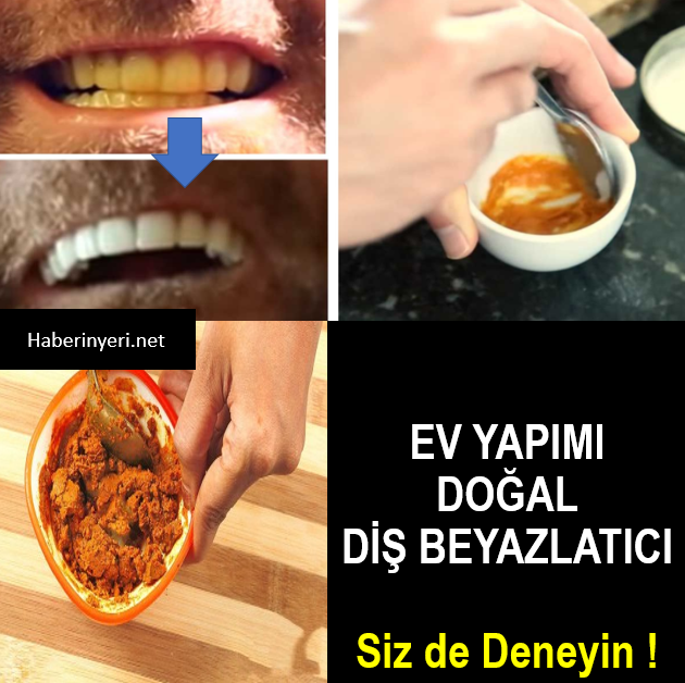 Evde Doğal Diş Beyazlatma