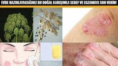 Doğal Sedef ve Egzama Kremi