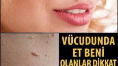 Vücudunda Et Beni Olanlar Dikkat