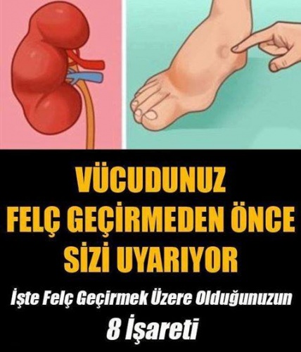 Vücudunuz Felç Geçirmeden Önce Sizi Uyarıyor