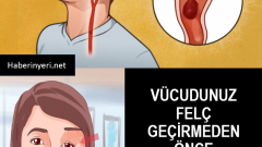 Felç Belirtilerine Dikkat