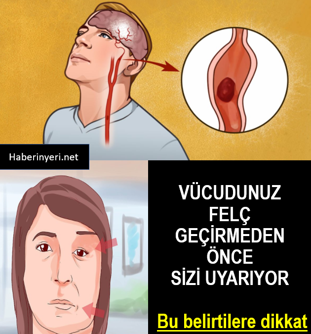 Felç Belirtilerine Dikkat