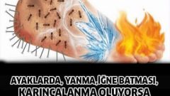 Ayaklardaki Yanma ve Karıncalanma İçin Neler Yapılmalı