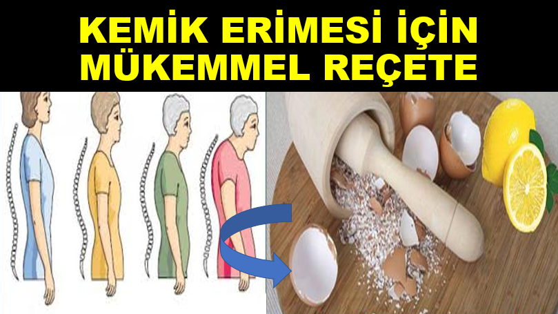 Kemik Erimesi İçin Mükemmel Kür