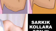 Kol Sarkması Neden Olur Ne Yapmalı