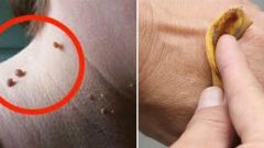 Muz Kabuğu İle Sadece 1 Haftada Çözebileceğiniz 6 Problem