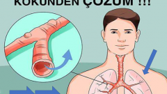 Bu doğal yöntemler balgamı ve öksürüğü hemen kesiyor