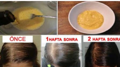 Mutfağınızdaki bu 3 ürün saç dökülmenizi aniden durduruyor!