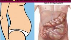 Karın Şişkinliğinden Kolayca Kurtulabilirsiniz.. Bakın Nasıl? İşte O Yöntem