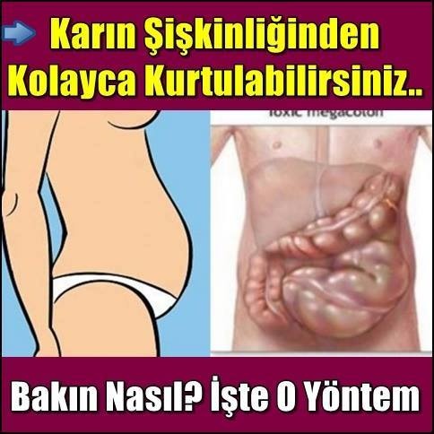 Karın Şişkinliğinden Kolayca Kurtulabilirsiniz.. Bakın Nasıl? İşte O Yöntem