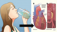 Suyu Böyle İçerek Sağlığınıza Sağlık Katın